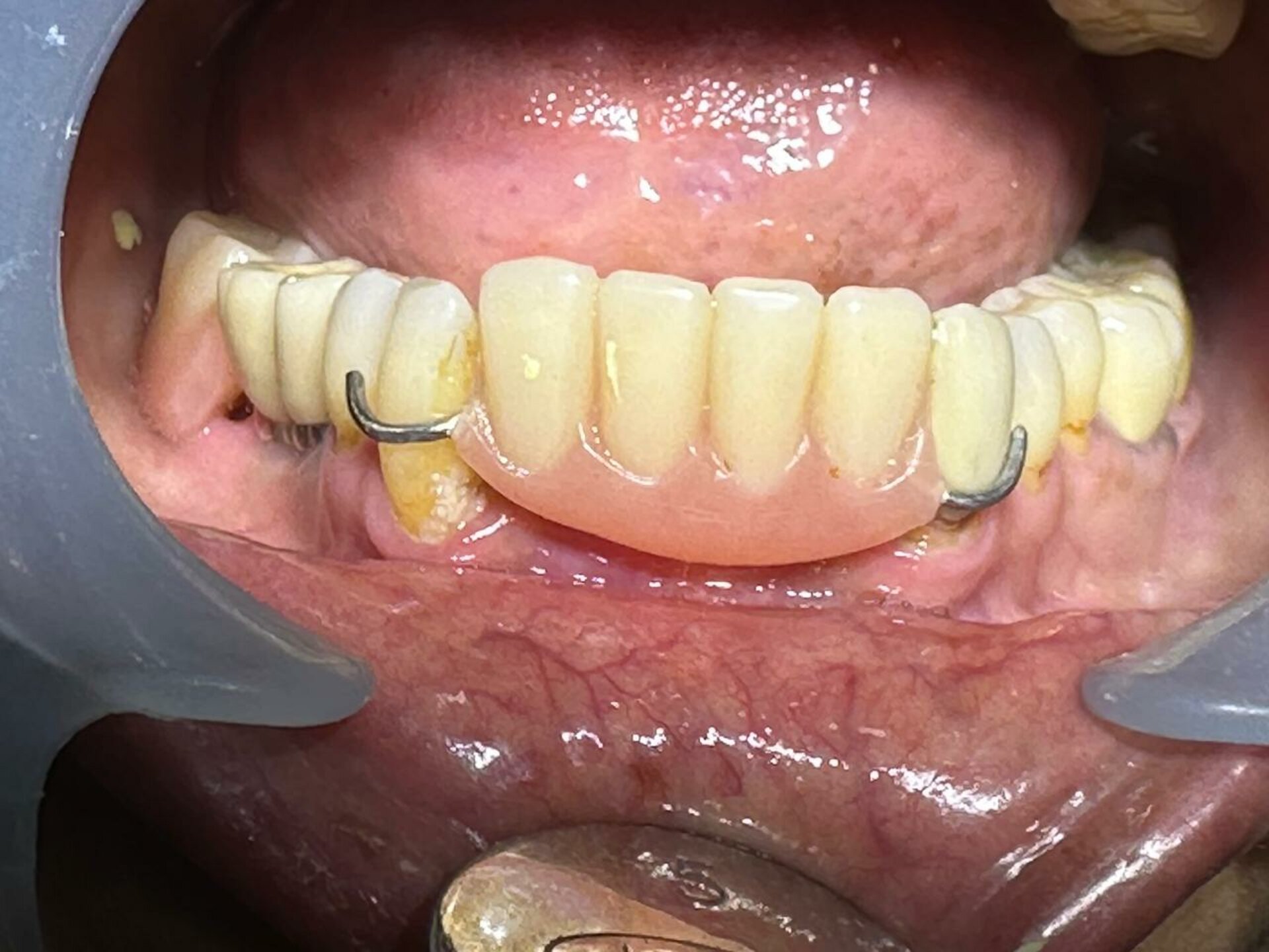 Phadke's Vitality Dental Clinic|Karve Nagar,Pune