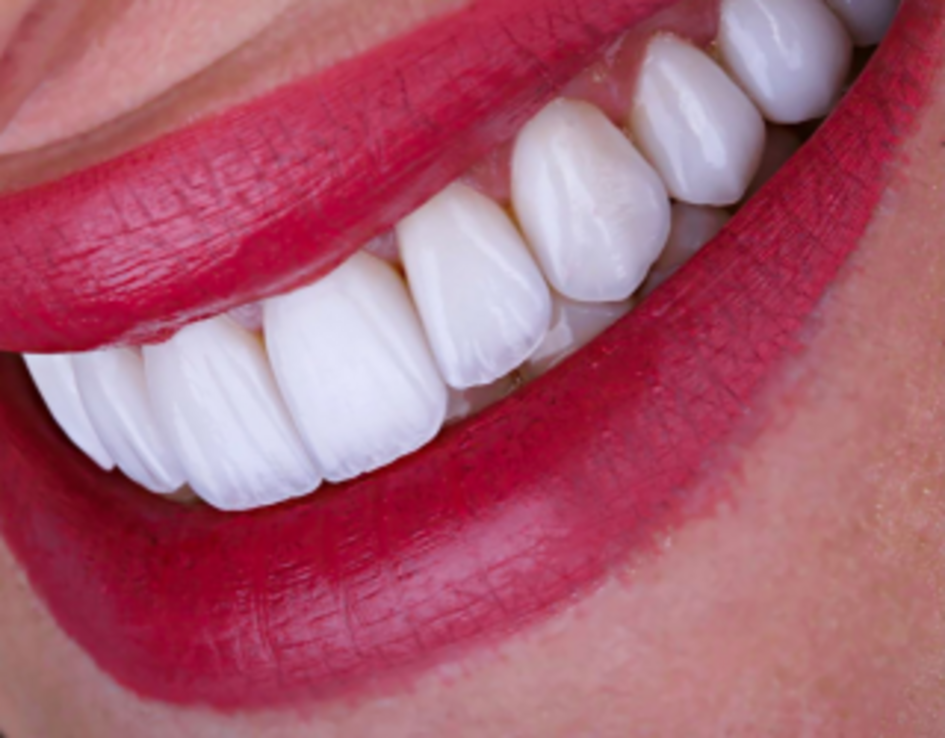 Cosmetic Dentistry