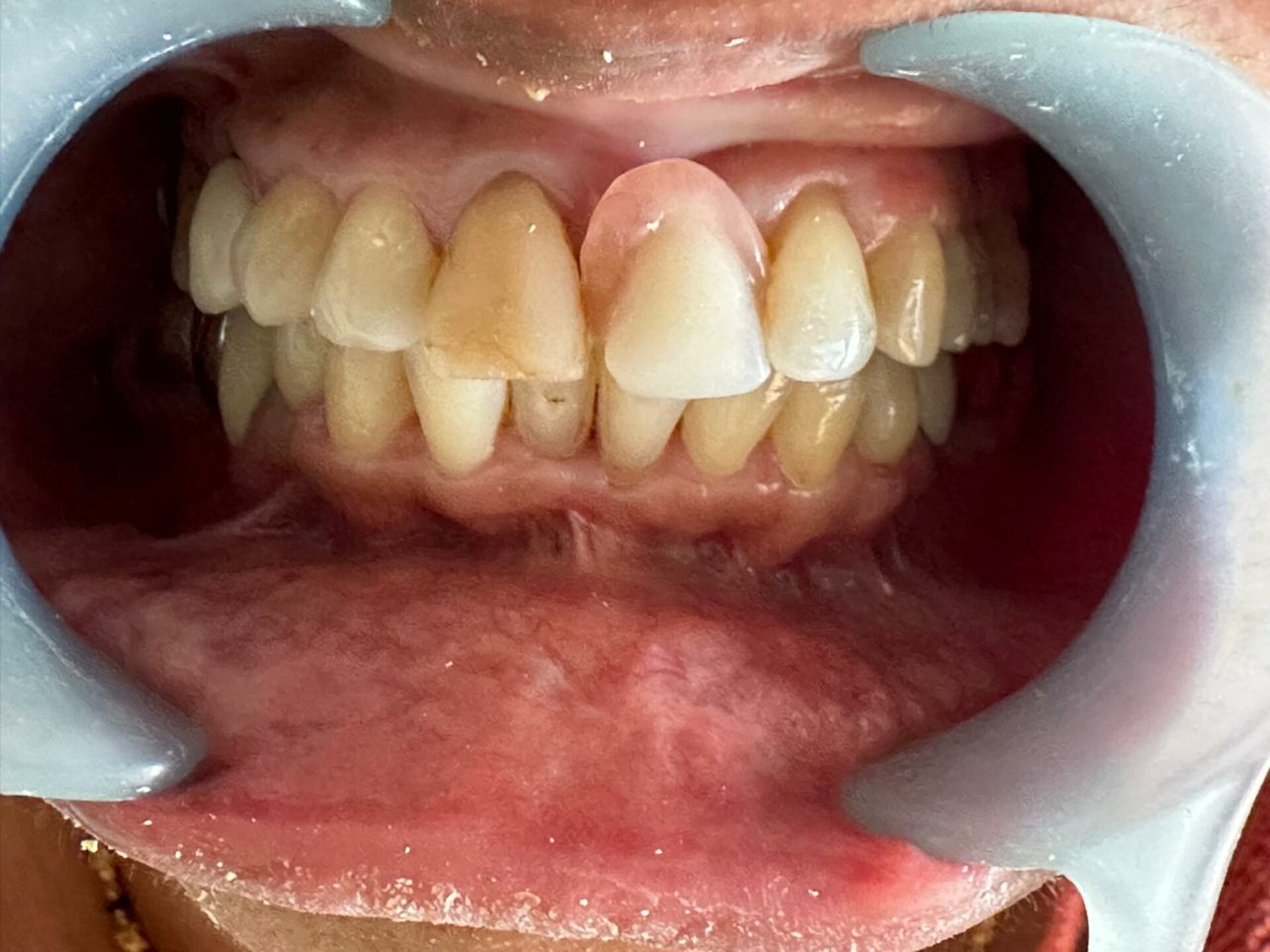 Phadke's Vitality Dental Clinic|Karve Nagar,Pune